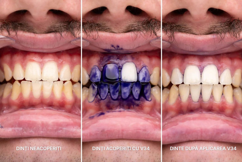 Ser V34 pentru Corectarea Culorii